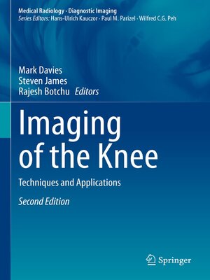 cover image of Imaging of the Knee